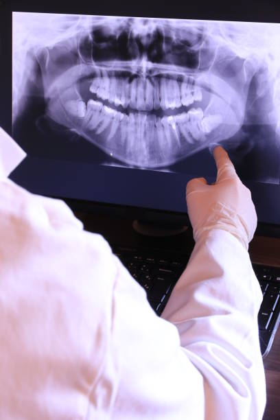 Best Knocked-Out Tooth (Avulsed Tooth) Treatment in Lytle, TX